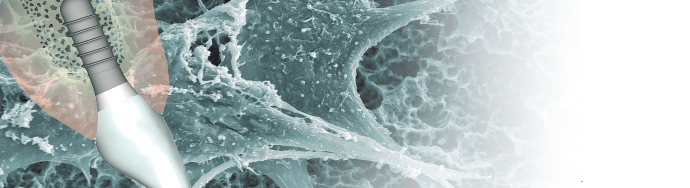 Dr. Marcus Klein - Knochenaufbau