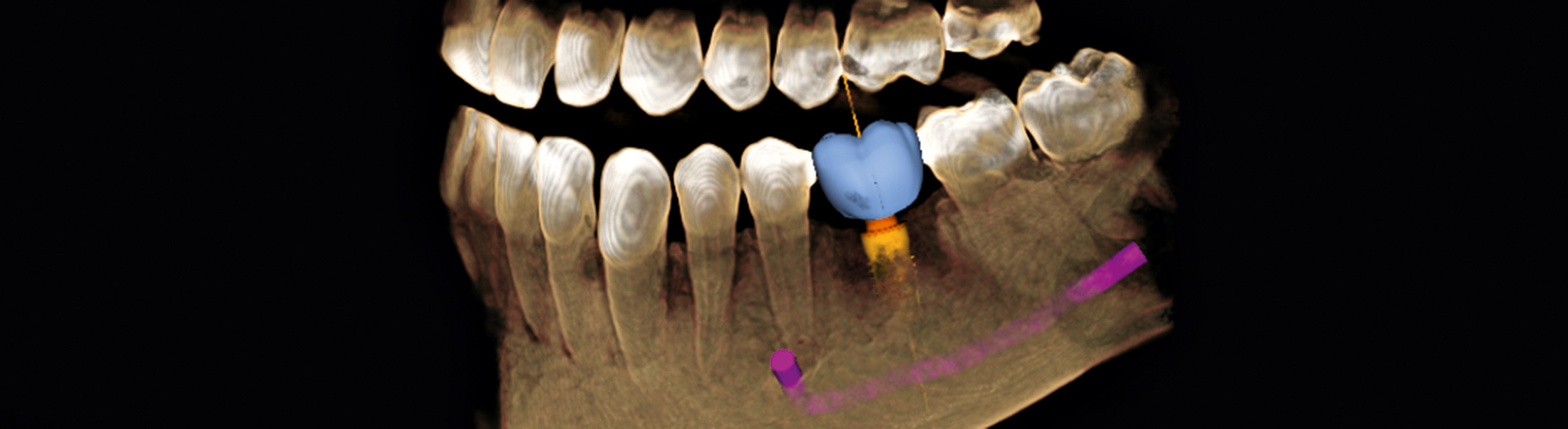 Dr. Marcus Klein - Diagnostik für Überweiser